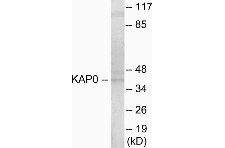 Western Blot - KAP0 Cell Based ELISA Kit (CB5838) - Antibodies.com