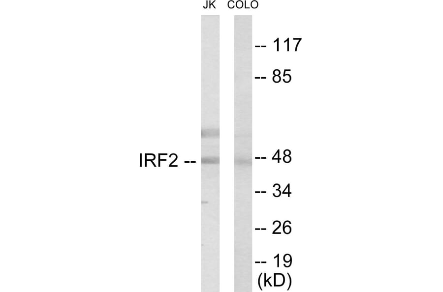 Western Blot - IRF2 Cell Based ELISA Kit (CB5841) - Antibodies.com