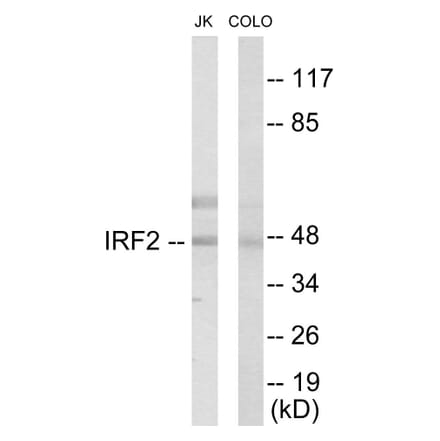 Western Blot - IRF2 Cell Based ELISA Kit (CB5841) - Antibodies.com