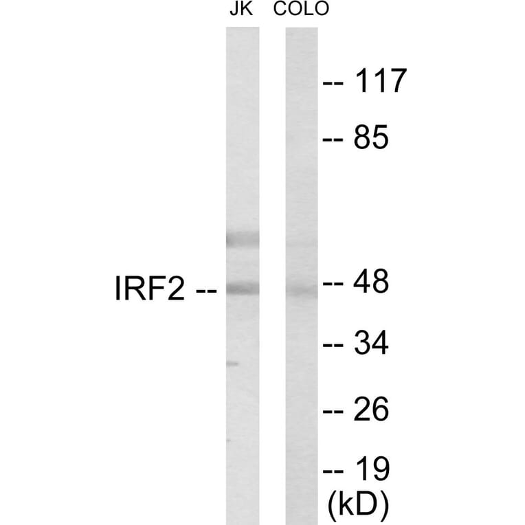 Western Blot - IRF2 Cell Based ELISA Kit (CB5841) - Antibodies.com