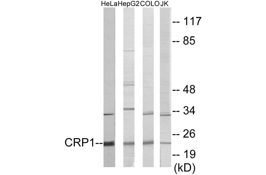 Western Blot - CRP1 Cell Based ELISA Kit (CB5856) - Antibodies.com