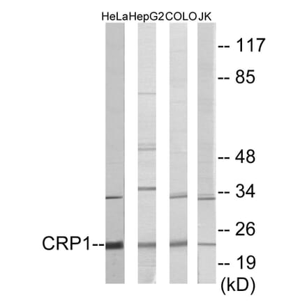 Western Blot - CRP1 Cell Based ELISA Kit (CB5856) - Antibodies.com