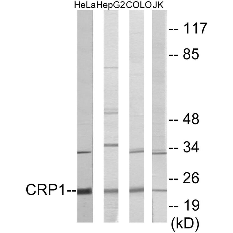 Western Blot - CRP1 Cell Based ELISA Kit (CB5856) - Antibodies.com