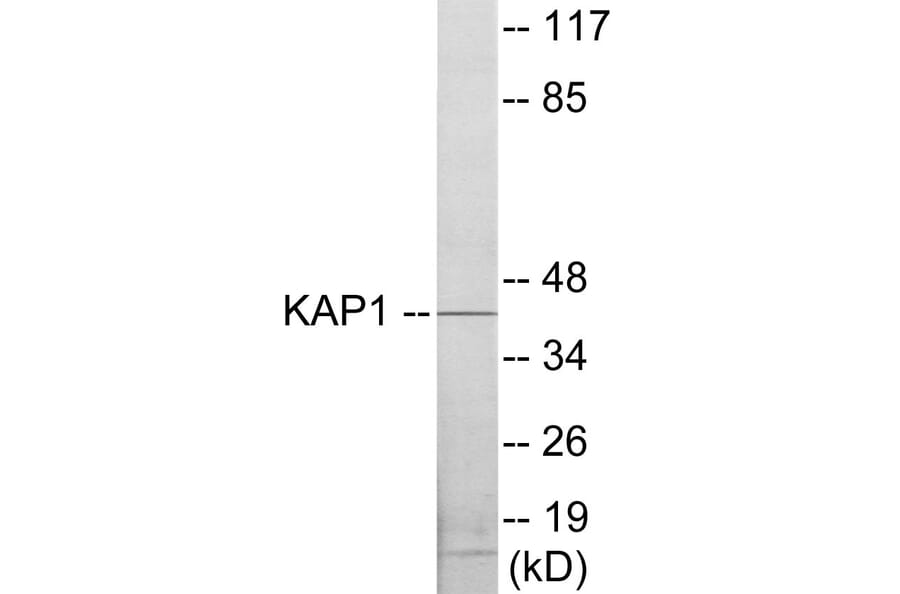 Western Blot - KAP1 Cell Based ELISA Kit (CB5875) - Antibodies.com