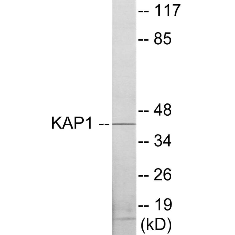 Western Blot - KAP1 Cell Based ELISA Kit (CB5875) - Antibodies.com