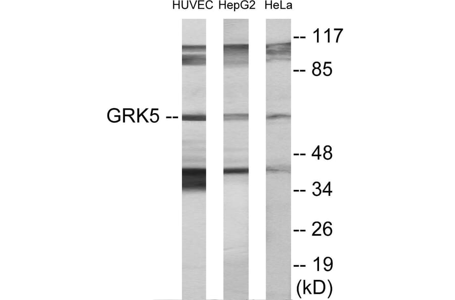 Western Blot - GRK5 Cell Based ELISA Kit (CB5877) - Antibodies.com