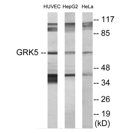 Western Blot - GRK5 Cell Based ELISA Kit (CB5877) - Antibodies.com