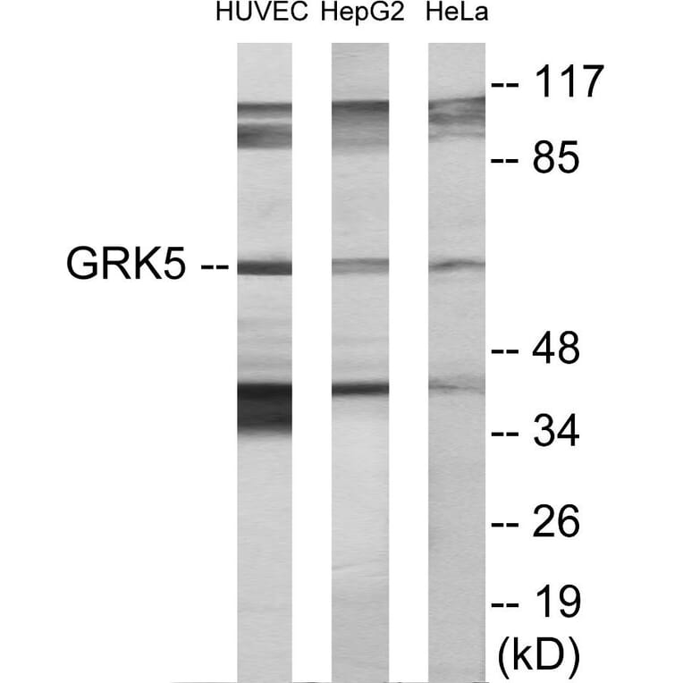 Western Blot - GRK5 Cell Based ELISA Kit (CB5877) - Antibodies.com
