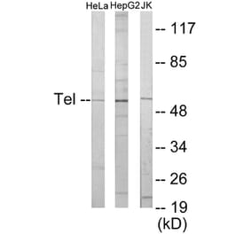 Western Blot - ETV6 Cell Based ELISA Kit (CB5886) - Antibodies.com