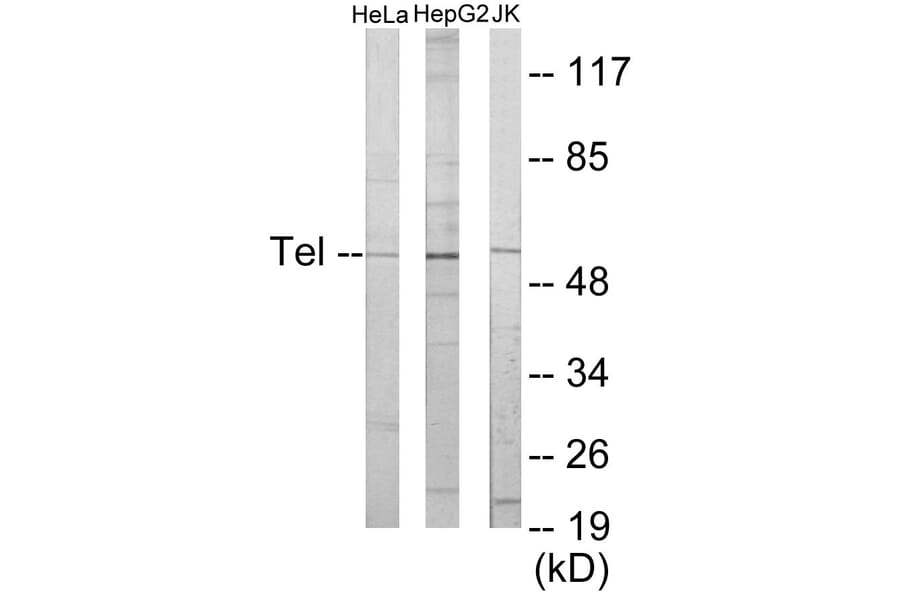 Western Blot - ETV6 Cell Based ELISA Kit (CB5886) - Antibodies.com