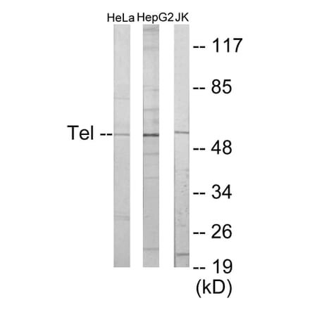 Western Blot - ETV6 Cell Based ELISA Kit (CB5886) - Antibodies.com