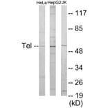 Western Blot - ETV6 Cell Based ELISA Kit (CB5886) - Antibodies.com
