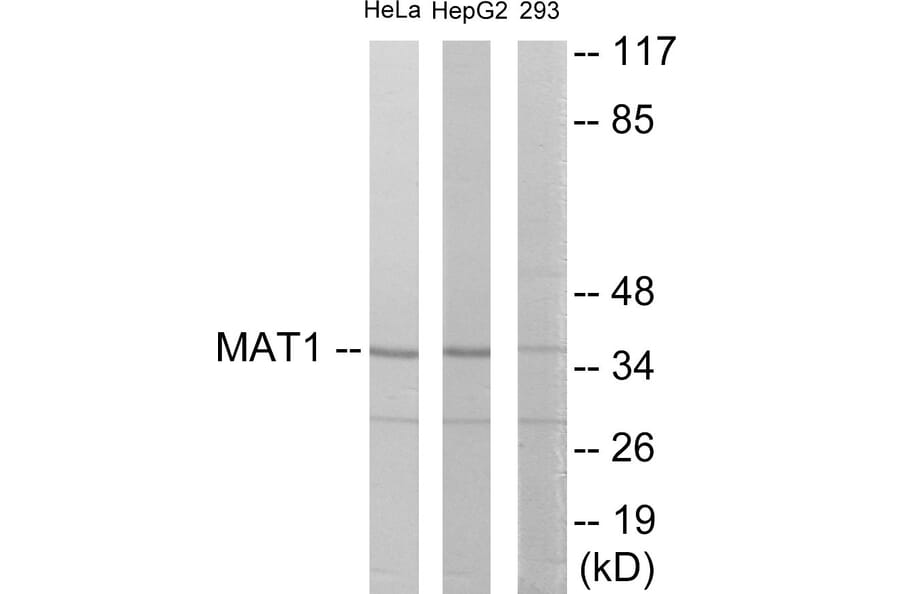 Western Blot - MAT1 Cell Based ELISA Kit (CB5910) - Antibodies.com