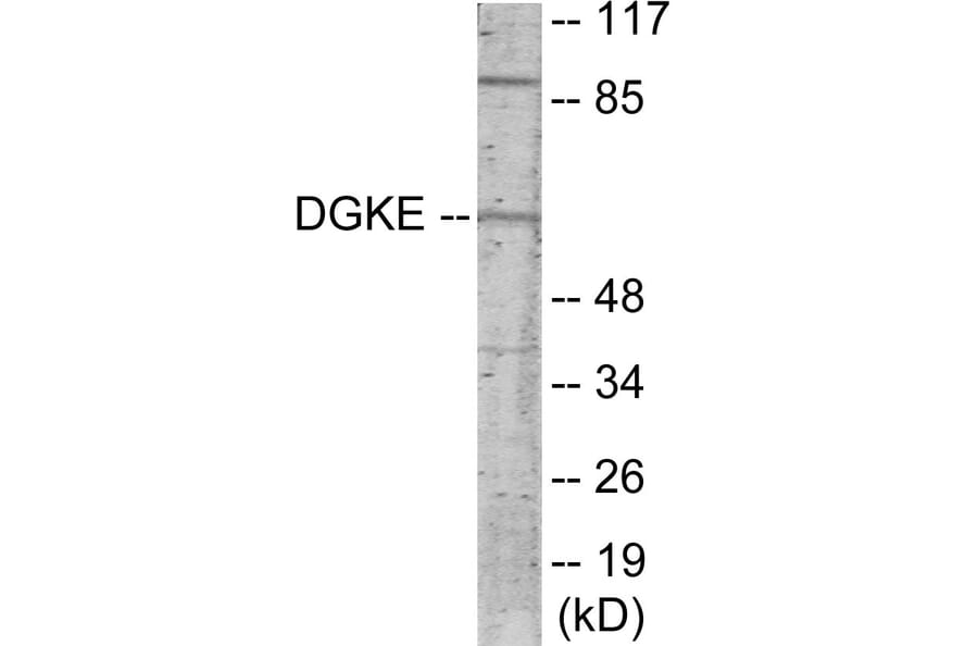 Western Blot - DGKE Cell Based ELISA Kit (CB5913) - Antibodies.com