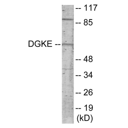 Western Blot - DGKE Cell Based ELISA Kit (CB5913) - Antibodies.com