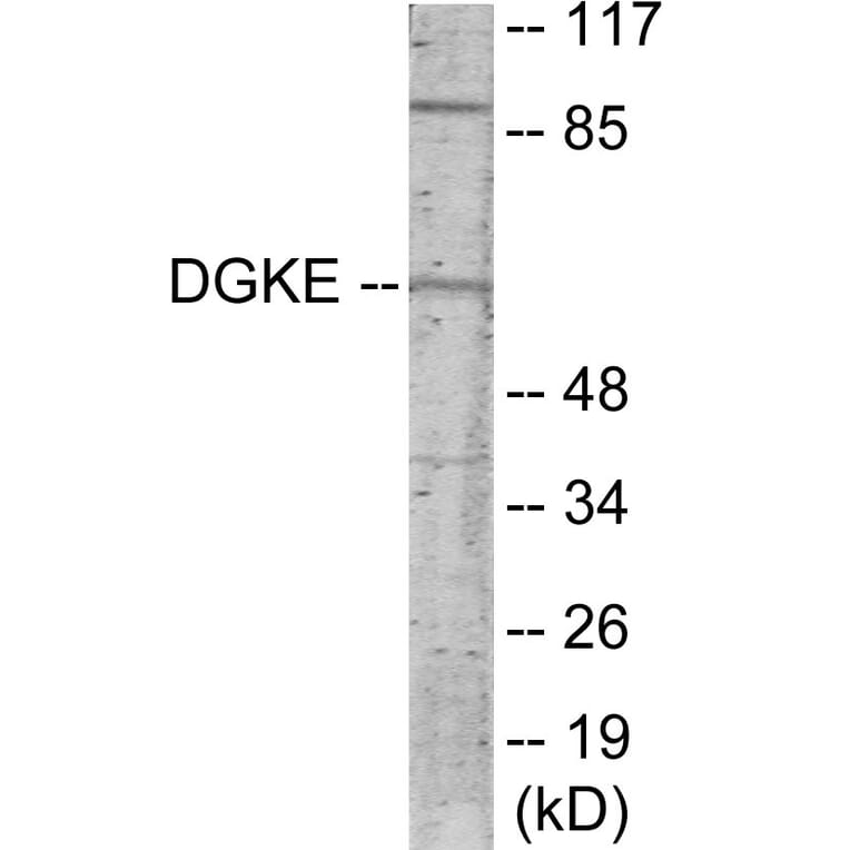 Western Blot - DGKE Cell Based ELISA Kit (CB5913) - Antibodies.com