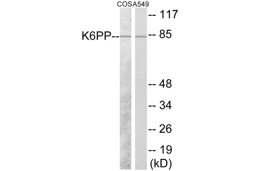 Western Blot - K6PP Cell Based ELISA Kit (CB5951) - Antibodies.com
