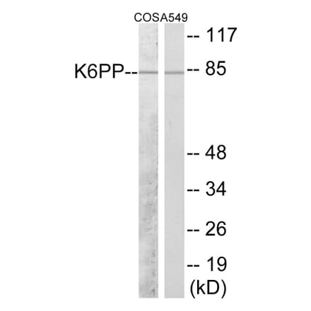 Western Blot - K6PP Cell Based ELISA Kit (CB5951) - Antibodies.com