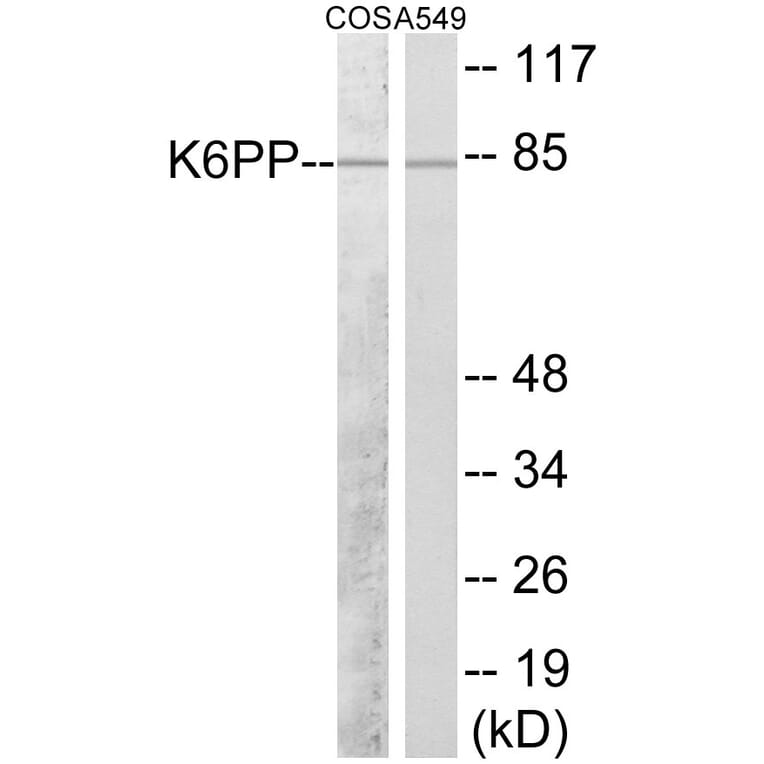 Western Blot - K6PP Cell Based ELISA Kit (CB5951) - Antibodies.com