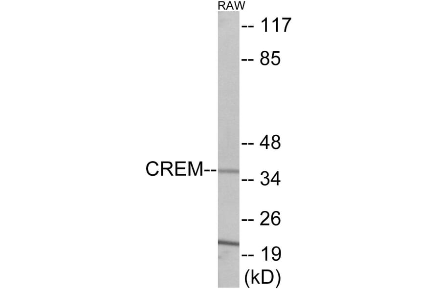 Western Blot - CREM Cell Based ELISA Kit (CB5955) - Antibodies.com