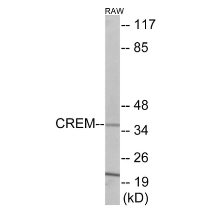 Western Blot - CREM Cell Based ELISA Kit (CB5955) - Antibodies.com