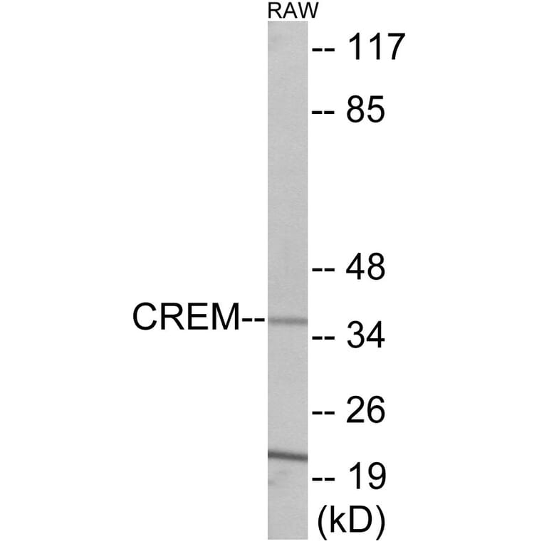 Western Blot - CREM Cell Based ELISA Kit (CB5955) - Antibodies.com