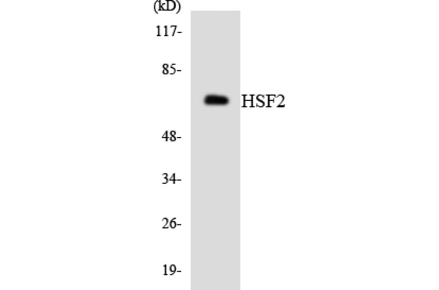 Western Blot - HSF2 Cell Based ELISA Kit (CB5958) - Antibodies.com