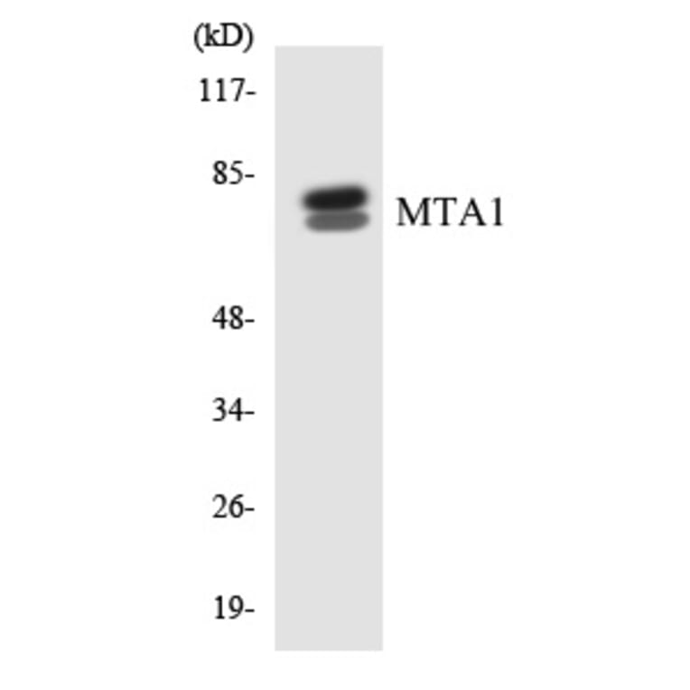 Western Blot - MTA1 Cell Based ELISA Kit (CB5986) - Antibodies.com