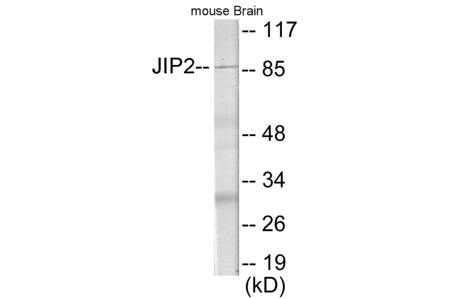 Western Blot - JIP2 Cell Based ELISA Kit (CB5987) - Antibodies.com
