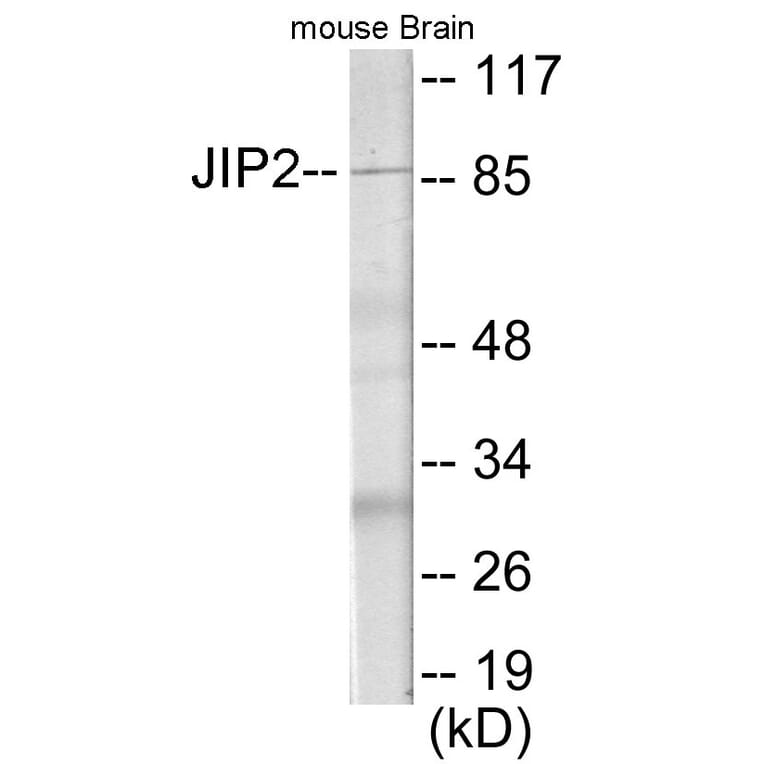 Western Blot - JIP2 Cell Based ELISA Kit (CB5987) - Antibodies.com
