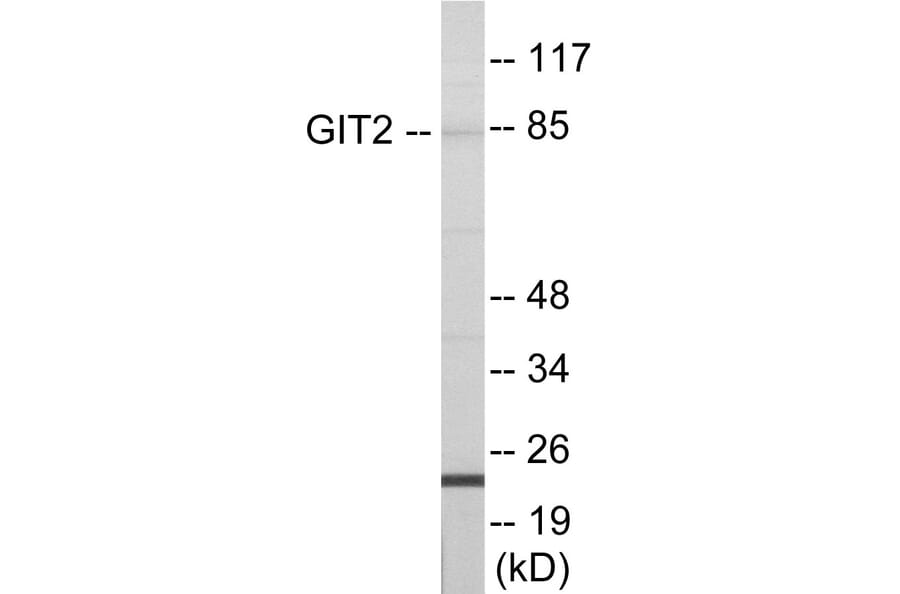 Western Blot - GIT2 Cell Based ELISA Kit (CB6000) - Antibodies.com