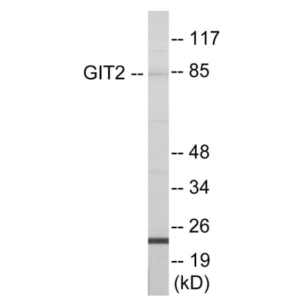 Western Blot - GIT2 Cell Based ELISA Kit (CB6000) - Antibodies.com