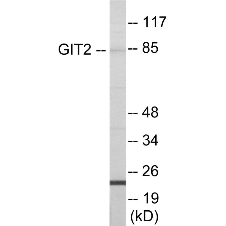 Western Blot - GIT2 Cell Based ELISA Kit (CB6000) - Antibodies.com