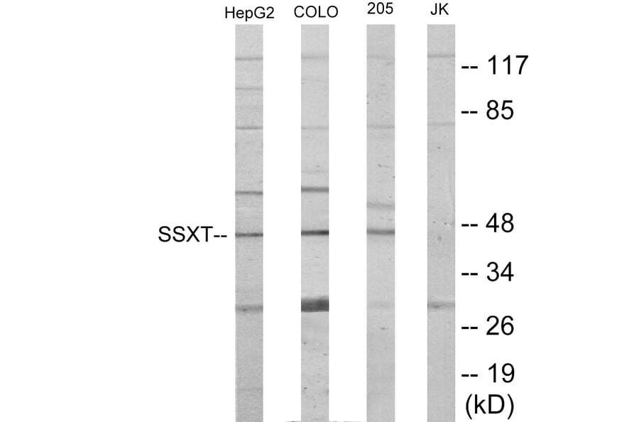 Western Blot - SSXT Cell Based ELISA Kit (CB6020) - Antibodies.com