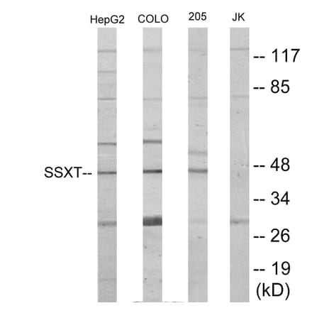 Western Blot - SSXT Cell Based ELISA Kit (CB6020) - Antibodies.com