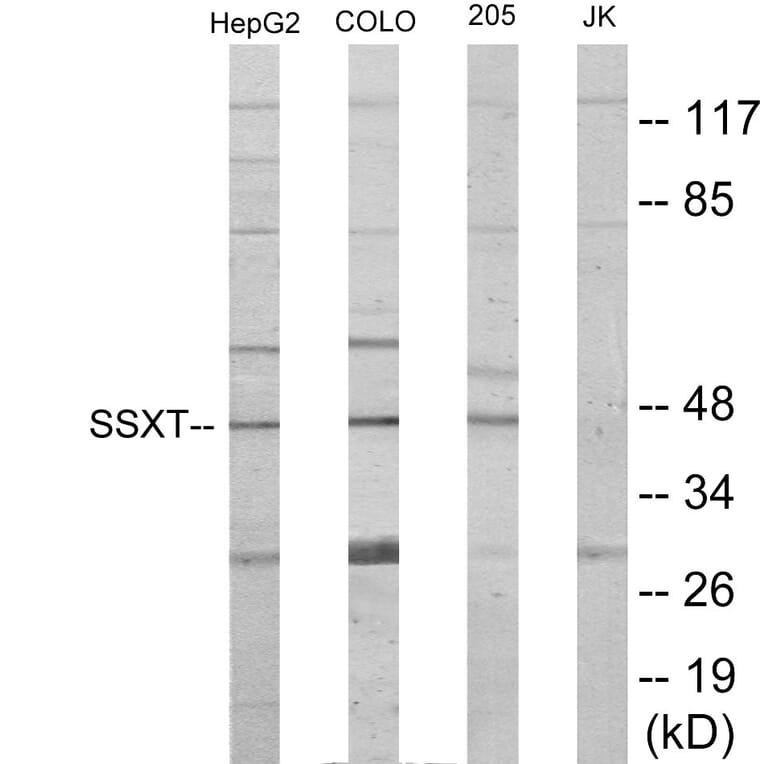 Western Blot - SSXT Cell Based ELISA Kit (CB6020) - Antibodies.com