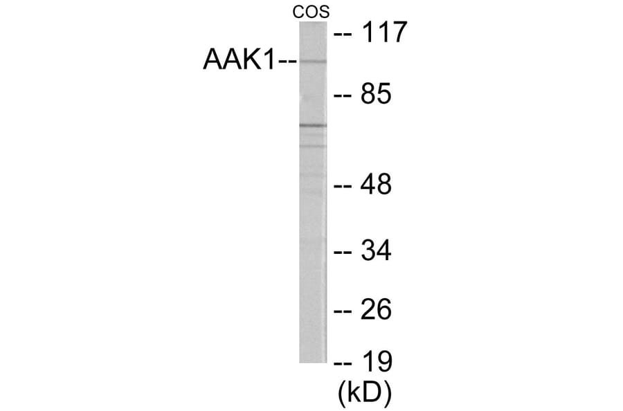 Western Blot - AAK1 Cell Based ELISA Kit (CB6045) - Antibodies.com