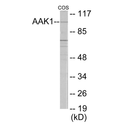 Western Blot - AAK1 Cell Based ELISA Kit (CB6045) - Antibodies.com