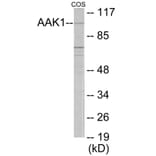 Western Blot - AAK1 Cell Based ELISA Kit (CB6045) - Antibodies.com