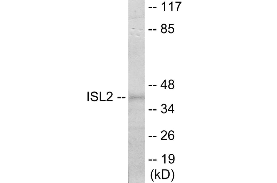 Western Blot - ISL2 Cell Based ELISA Kit (CB6108) - Antibodies.com