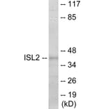Western Blot - ISL2 Cell Based ELISA Kit (CB6108) - Antibodies.com
