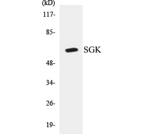 Western Blot - SGK Cell Based ELISA Kit (CB5627) - Antibodies.com