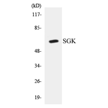Western Blot - SGK Cell Based ELISA Kit (CB5627) - Antibodies.com