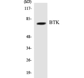 Western Blot - BTK Cell Based ELISA Kit (CB5081) - Antibodies.com