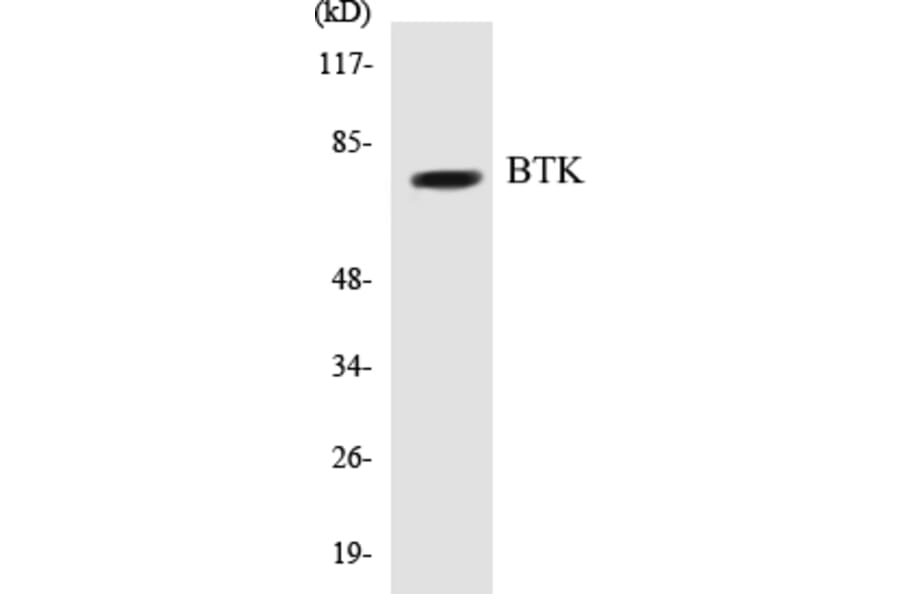 Western Blot - BTK Cell Based ELISA Kit (CB5081) - Antibodies.com