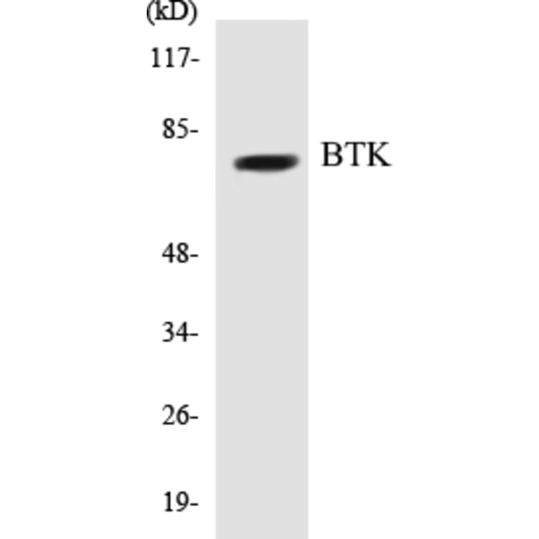 Western Blot - BTK Cell Based ELISA Kit (CB5081) - Antibodies.com