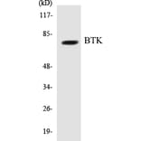 Western Blot - BTK Cell Based ELISA Kit (CB5081) - Antibodies.com