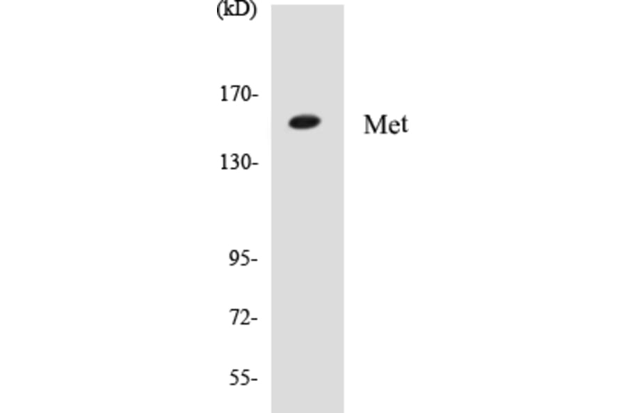 Western Blot - Met Cell Based ELISA Kit (CB5444) - Antibodies.com