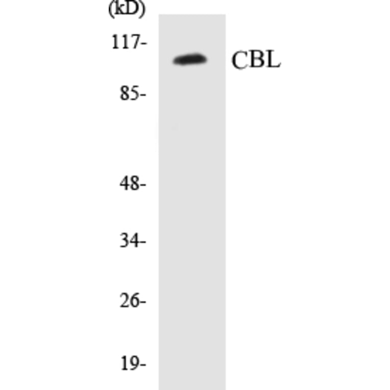 Western Blot - CBL Cell Based ELISA Kit (CB5110) - Antibodies.com