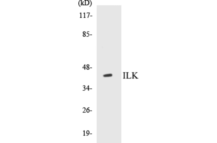 Western Blot - ILK Cell Based ELISA Kit (CB5368) - Antibodies.com